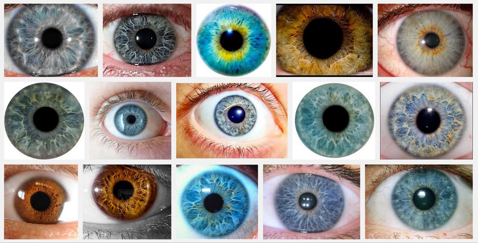 What Is Iris Color Chart Iriscope Iridology Camera Iriscope 