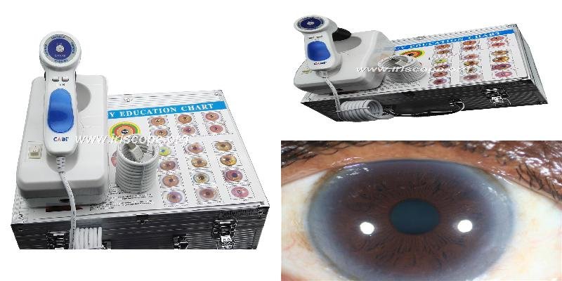 best iridology camera