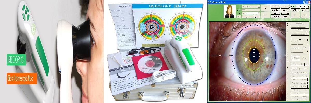 iridology camera software