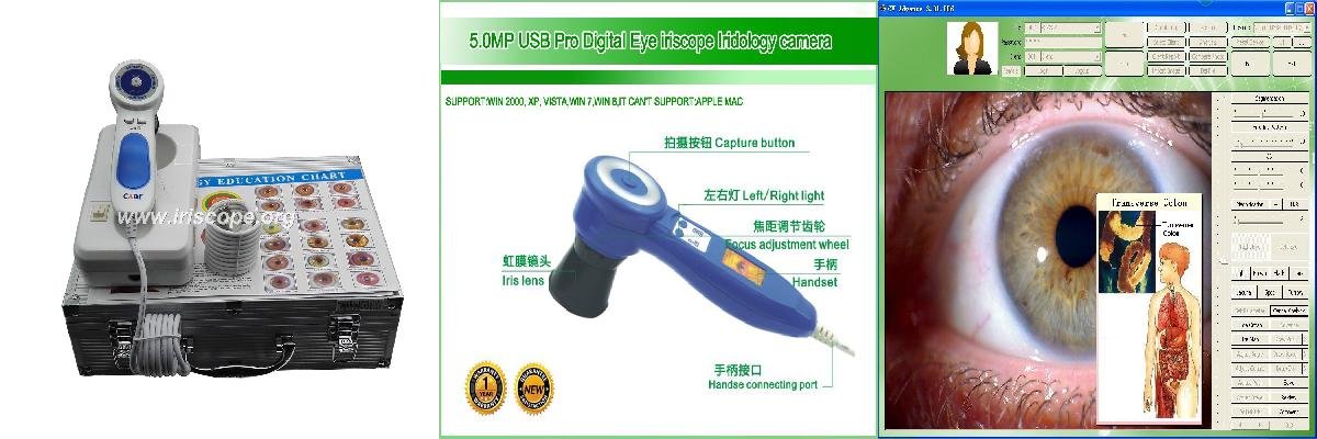 camara iriscopio
