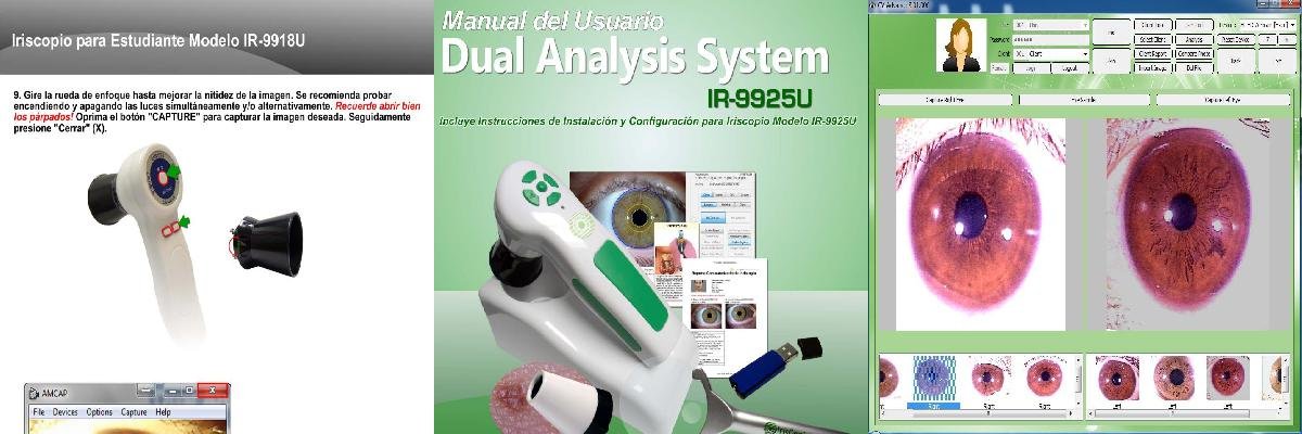 iridology camera australia