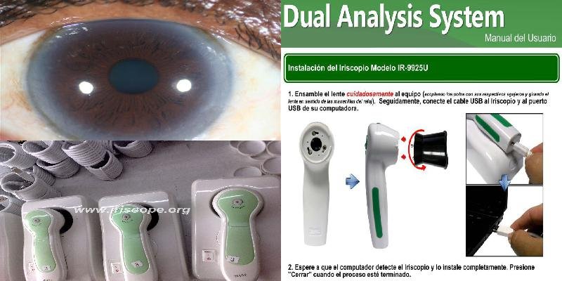 iridology camera australia