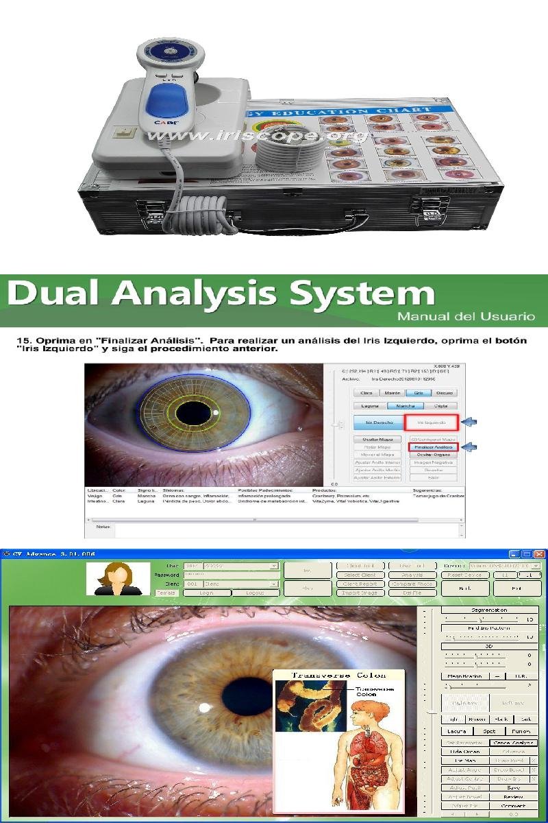 iridology camera australia