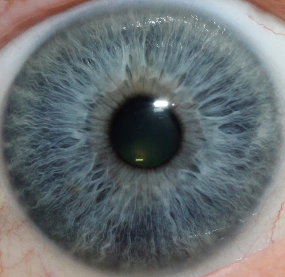 iridology pictures 2