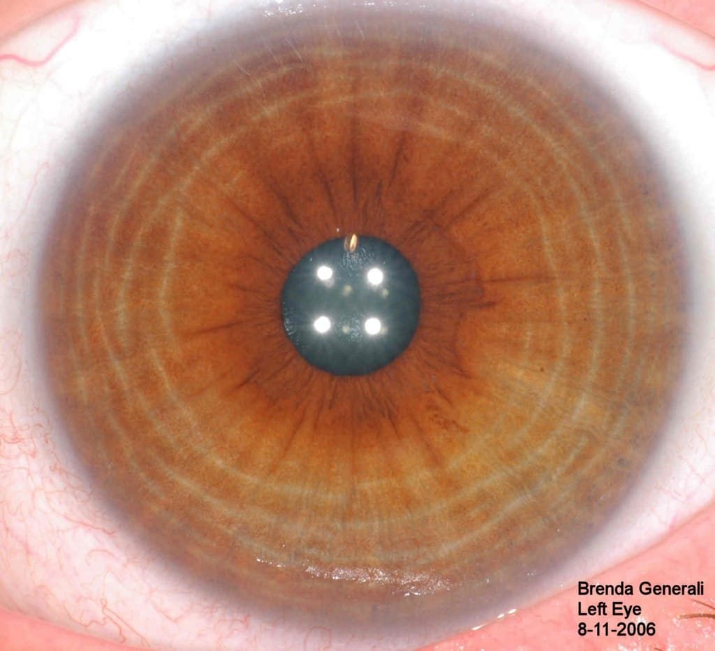 Online Iridology Classes (1)