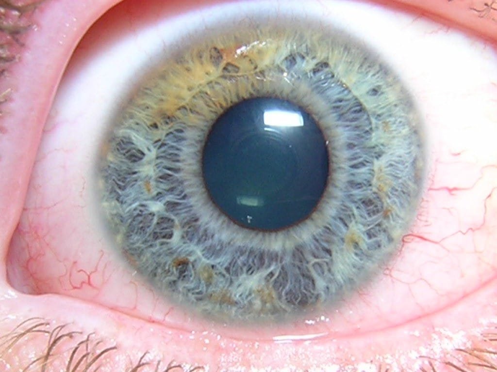 iridology brisbane 4