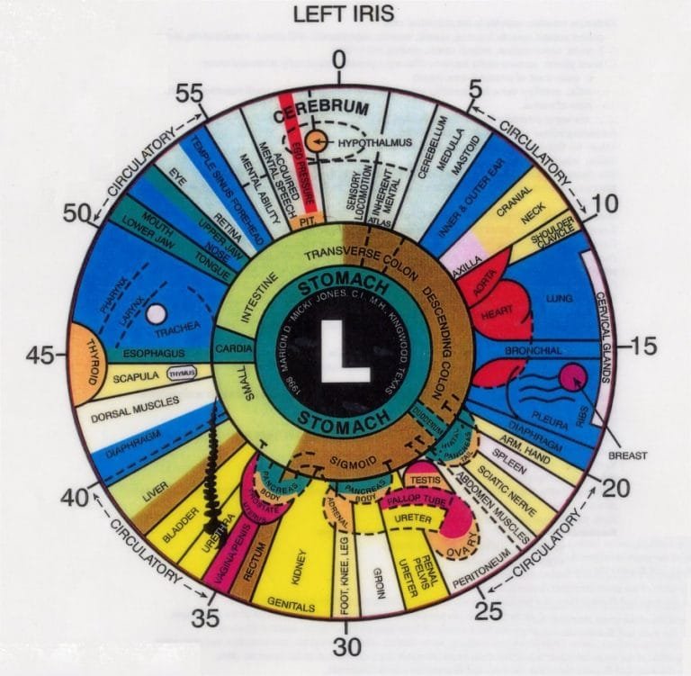 What Is Left Eye Iridology Chart? MAIKONG Iridology Camera & Iriscope