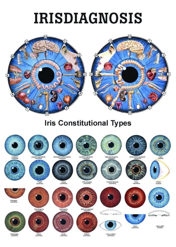What is iridology eye chart diagnosis? iriscope iridology camera Eye Chart Iridology